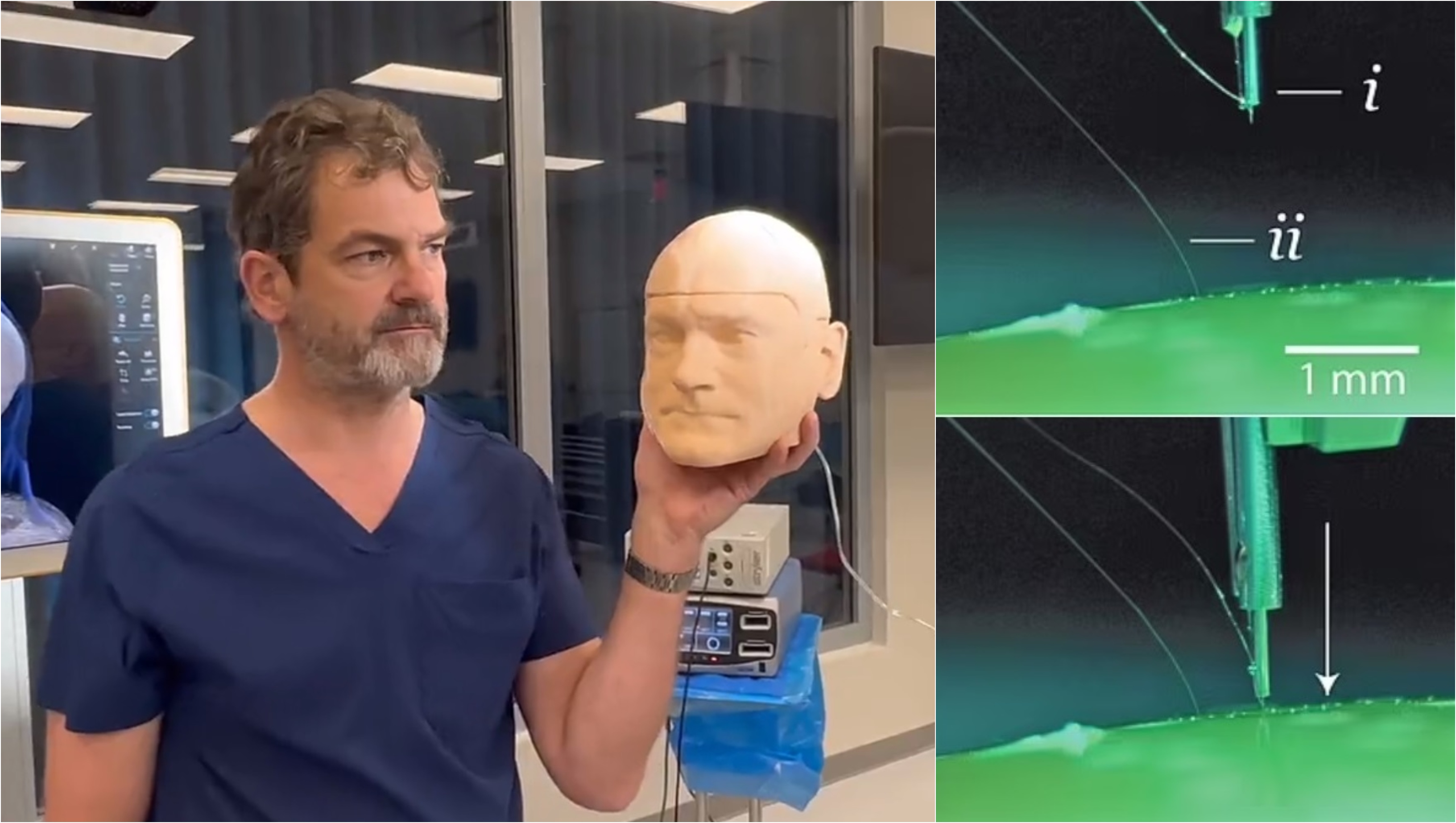 Ce se întâmplă dacă ți se implantează în creier cipul Neuralink al lui Elon Musk