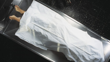Dead body in a mortuary