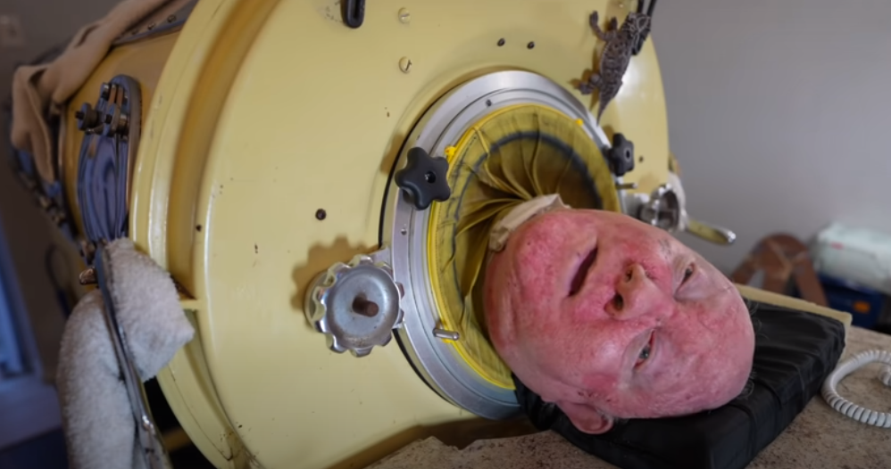 Bărbatul care a trăit 7 decenii într-un cilindru metalic a murit la 78 de ani. Povestea lui Paul și cum a ajuns în „plămânul de fier”