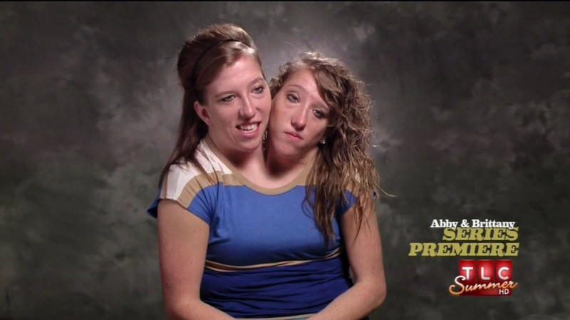 Conjoined twins Abby and Brittany Hensel premiere their own reality show.