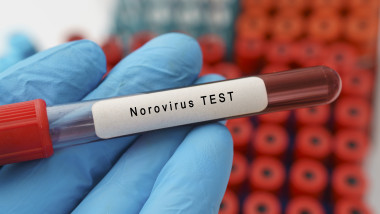 test norovirus
