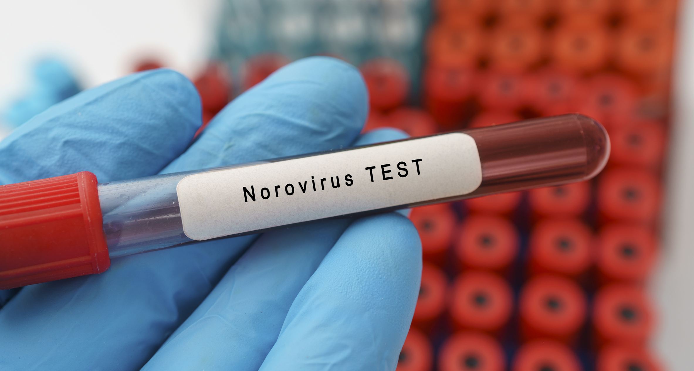 Ce este norovirusul, infecția găsită la un liceu din Timișoara. Se transmite rapid și poate rămâne câteva zile pe suprafețe