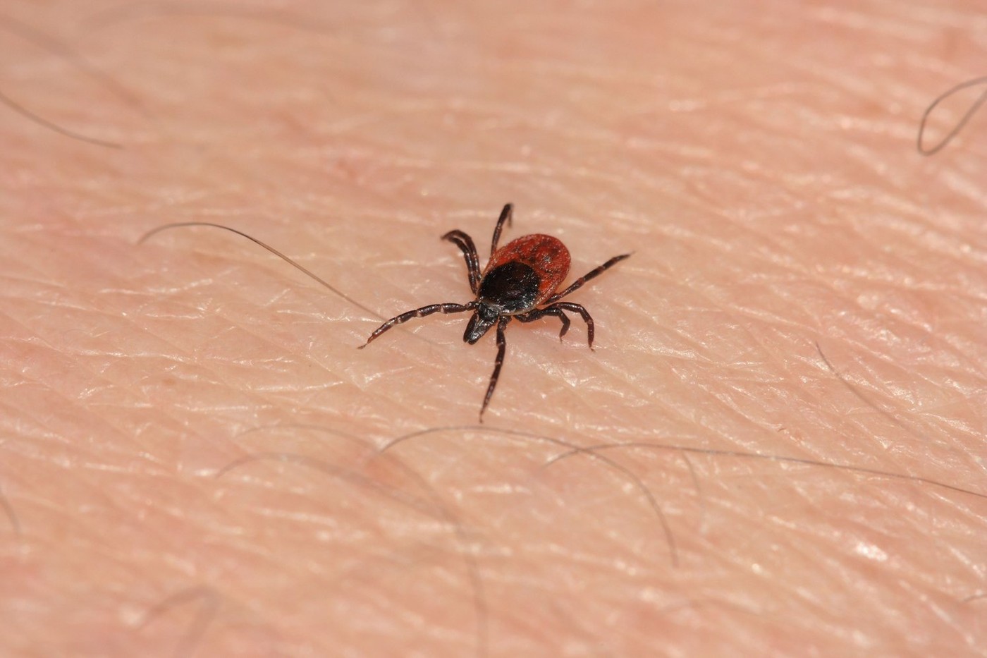 Temperaturile de vară au dus la apariția căpușelor. Mai mulți oameni mușcați de insecte au mers la urgențe. Ce recomandă medicii