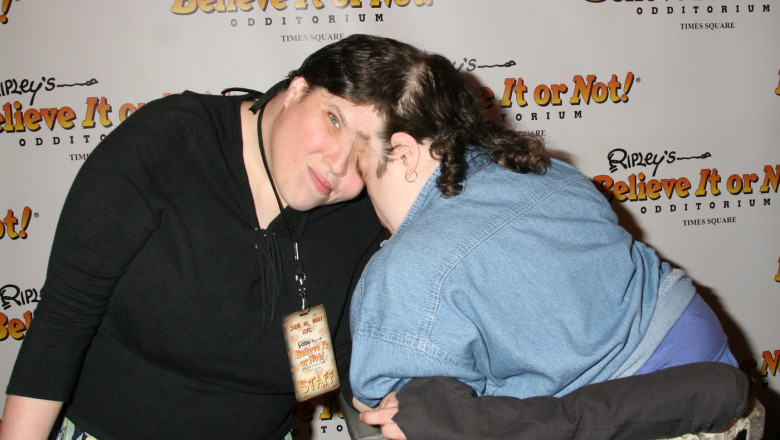 The World's Oldest Conjoined Twins at the official opening of "Ripley's Believe It Or Not Odditorium" in New York