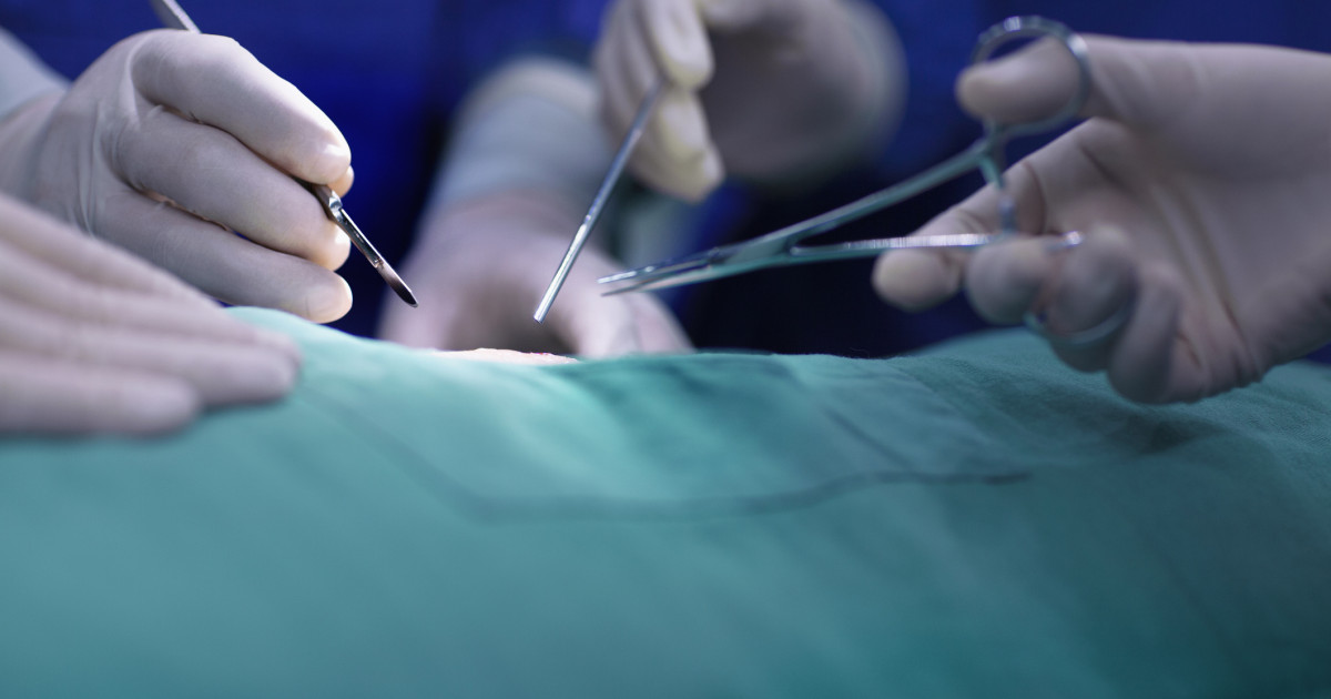 O tumoră de 45 de kilograme a fost scoasă din abdomenul unei femei din Botoșani, care a mers la medic când a văzut că se îngrașă brusc|EpicNews