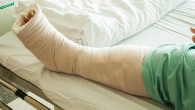 Un pacient cu piciorul rupt a așteptat 10 zile să fie operat