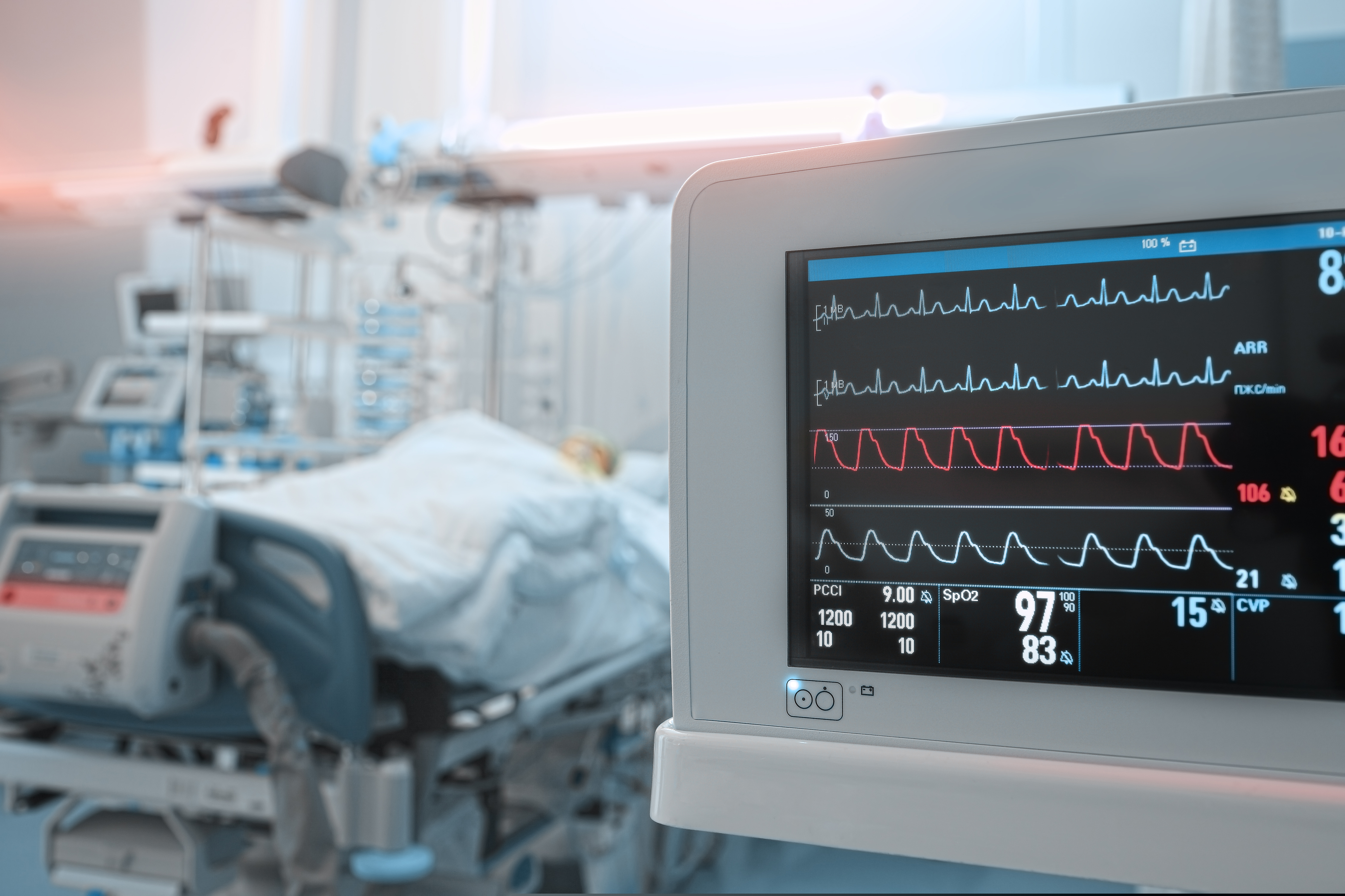 Ministerul Sănătății vrea să cumpere echipamente medicale pentru secțiile ATI din țară
