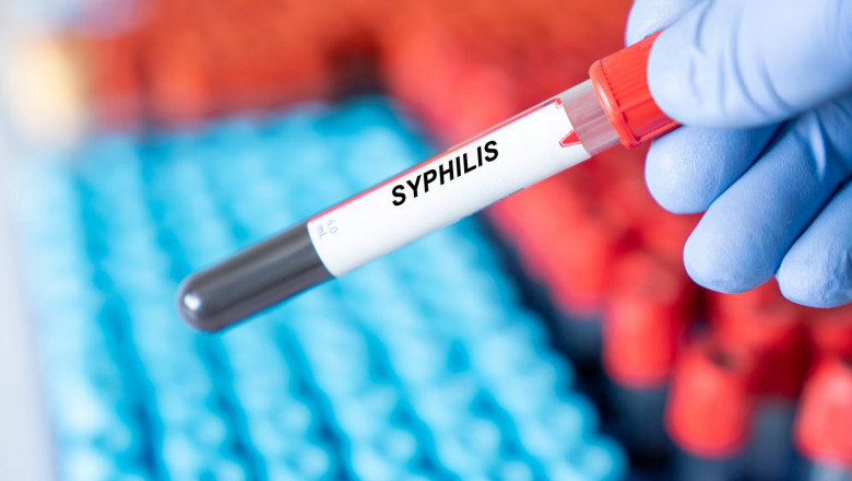 eprubeta de test sifilis