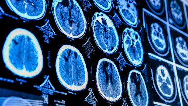 Imagini ale creierului scanat Foto: Shutterstock