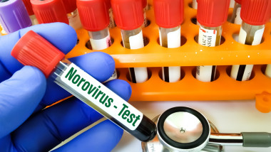 analiza norovirus