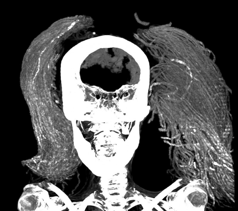 'Screaming Woman' mummy may have died in agony 3,500 years ago, suggests study