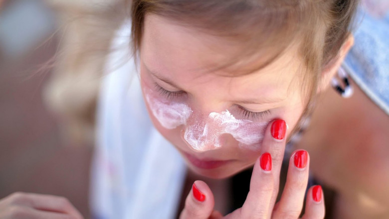 close-up, the child, girls, severe sunburn on the face. Mom smears places of burns abundantly with a special cream. Mother applying sun protection cream to her daughter face. High quality photo