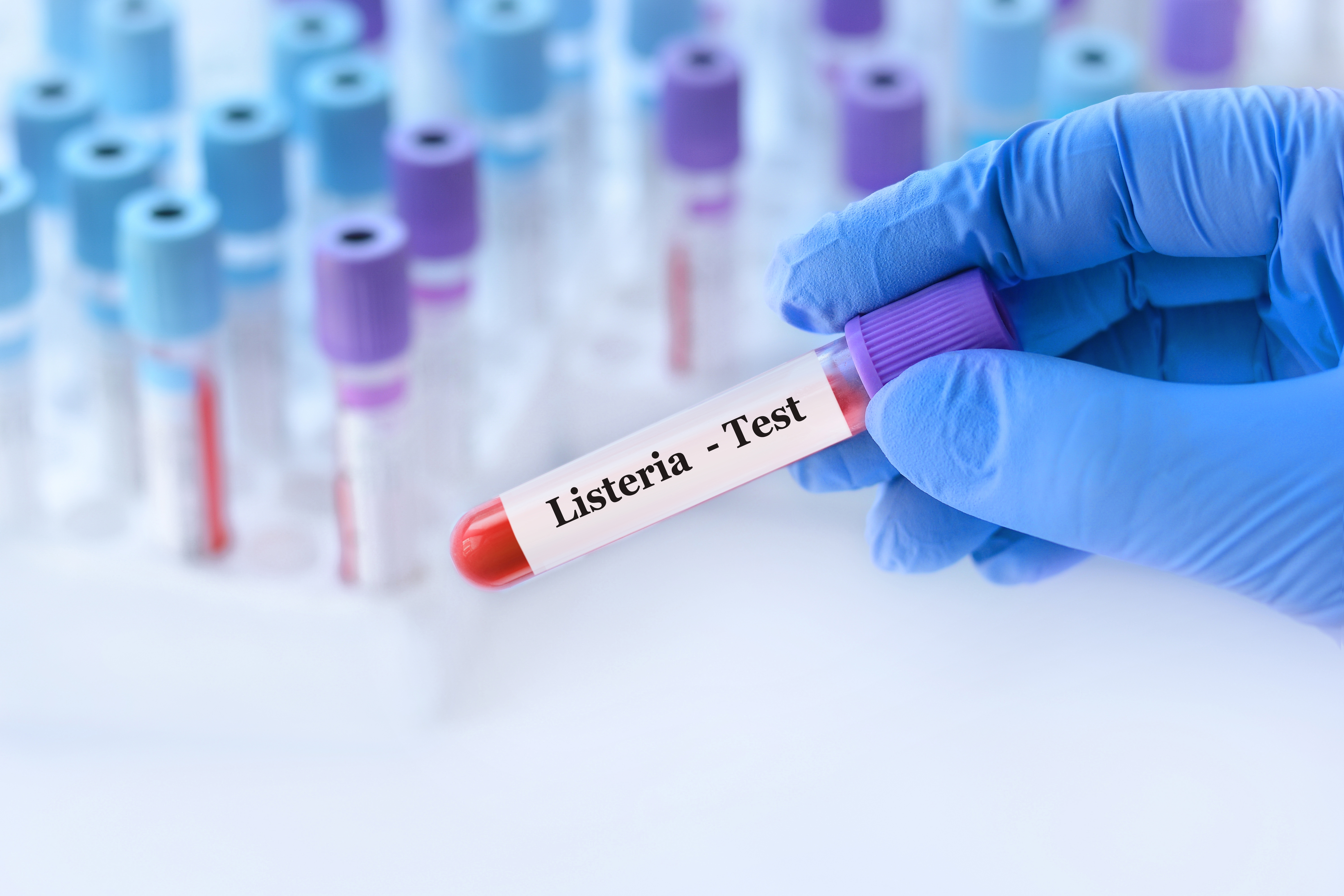 Ce este Listeria, bacteria care poate provoaca toxiinfecție alimentară pentru mai multe categorii de persoane