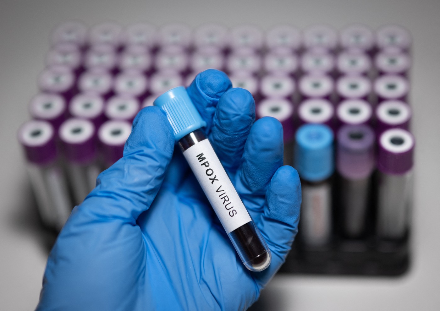Primul test care poate detecta virusul mpox, cu rezultate imediate, a fost aprobat de OMS