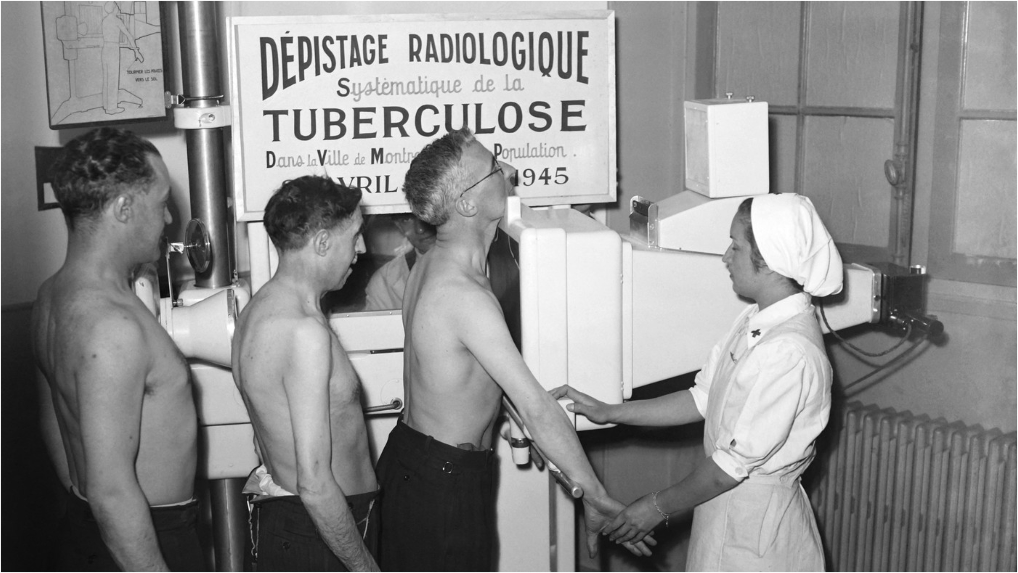 Cum au ajutat țigările, ciocolata și pizza la combaterea unei epidemii de tuberculoză (BBC)