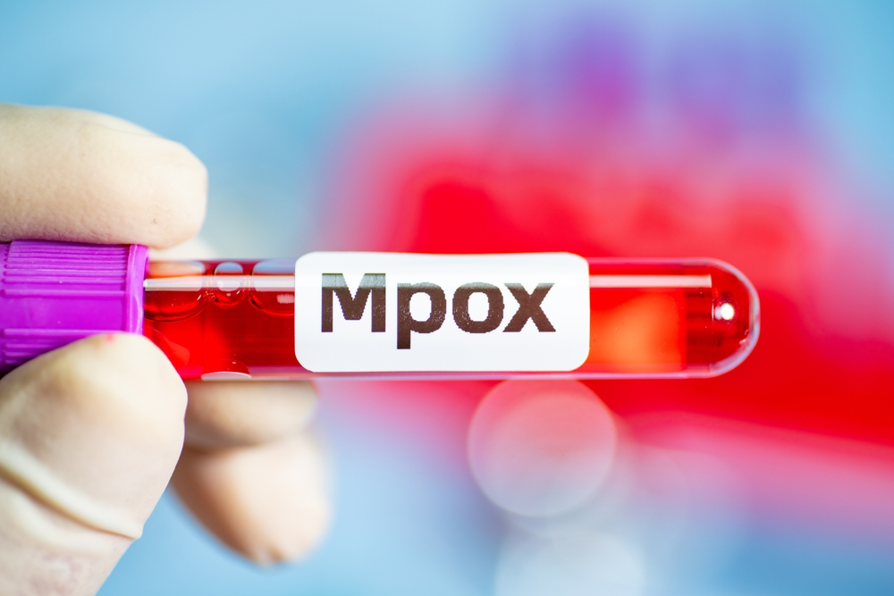 Primul caz de îmbolnăvire cu noua variantă mpox detectat în Franța