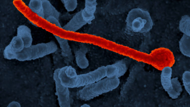 Ebola virus Makona