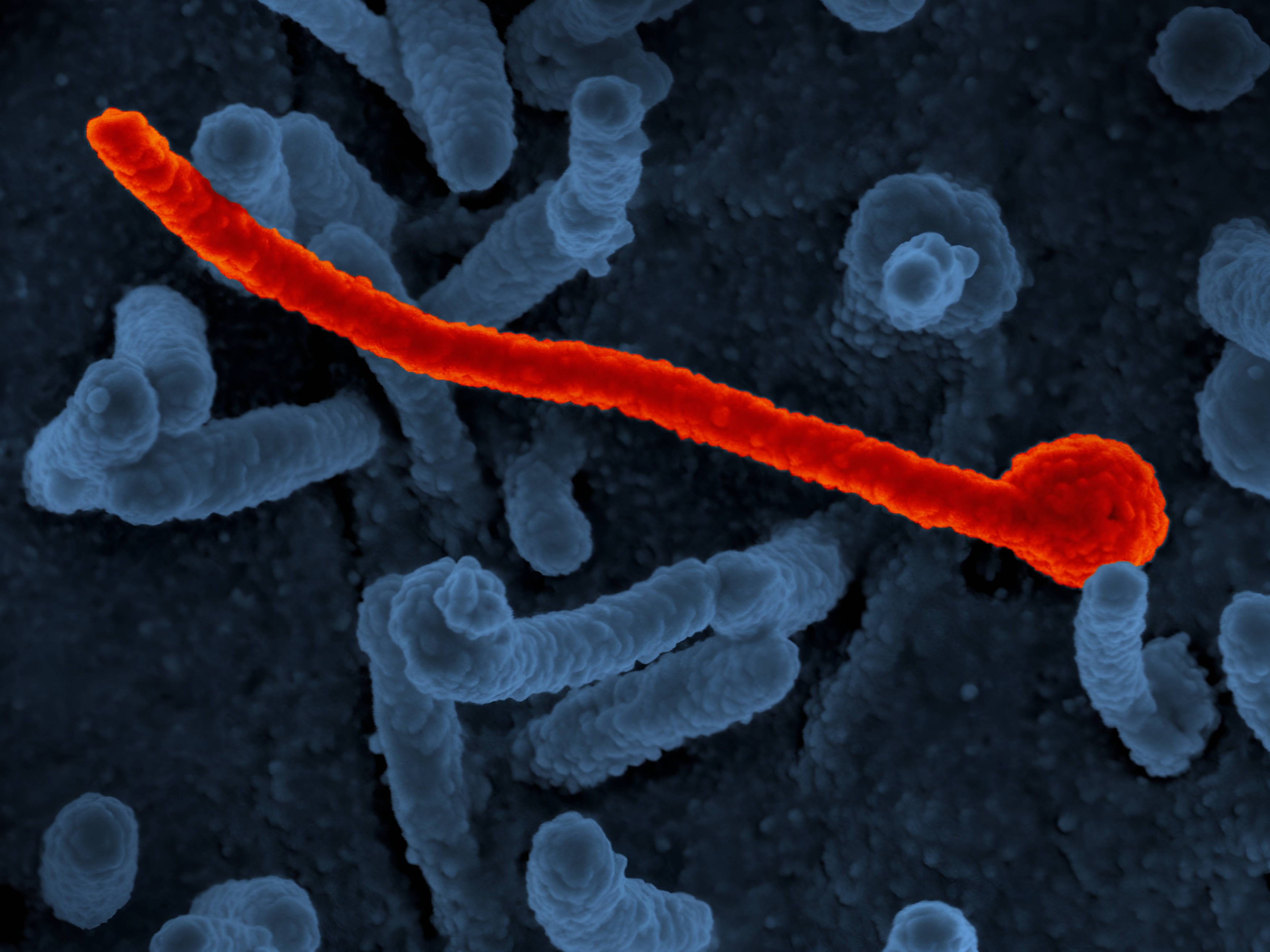 Epidemie de Ebola în estul Africii. Un focar de îmbolnăviri a izbucnit în Uganda