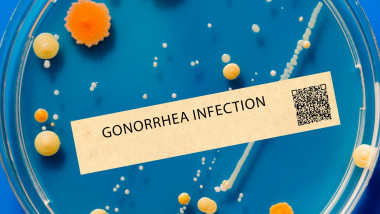 Infecție Gonoreea