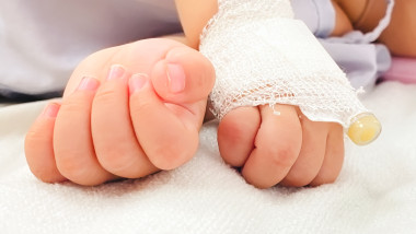 Closeup,Saline,Drip,Into,Child's,Hand,On,Bed,At,The