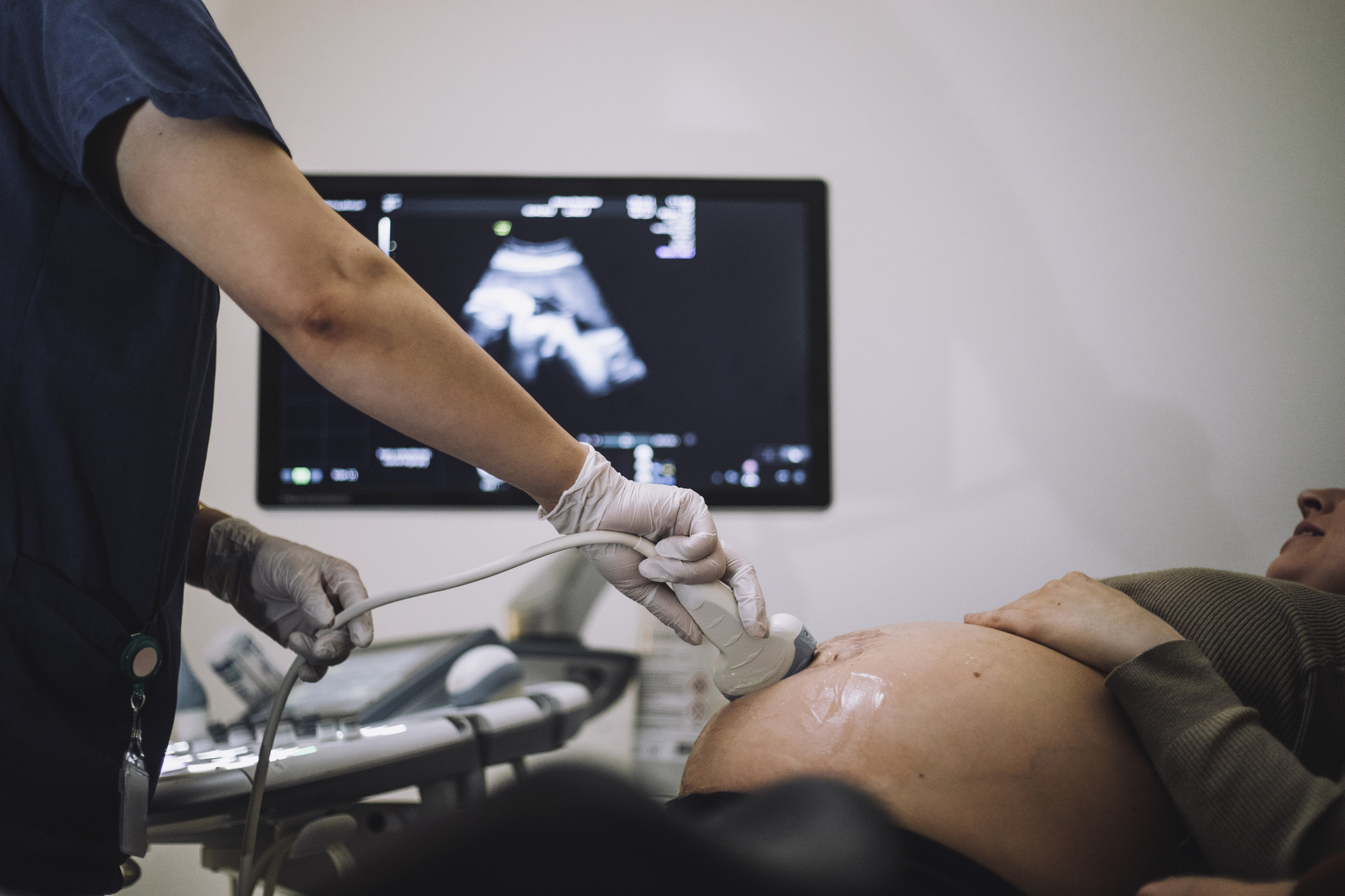 Un sfert dintre femeile însărcinate din România nu merg la controalele medicale, iar urmările pot fi dramatice. Avertismentul medicilor