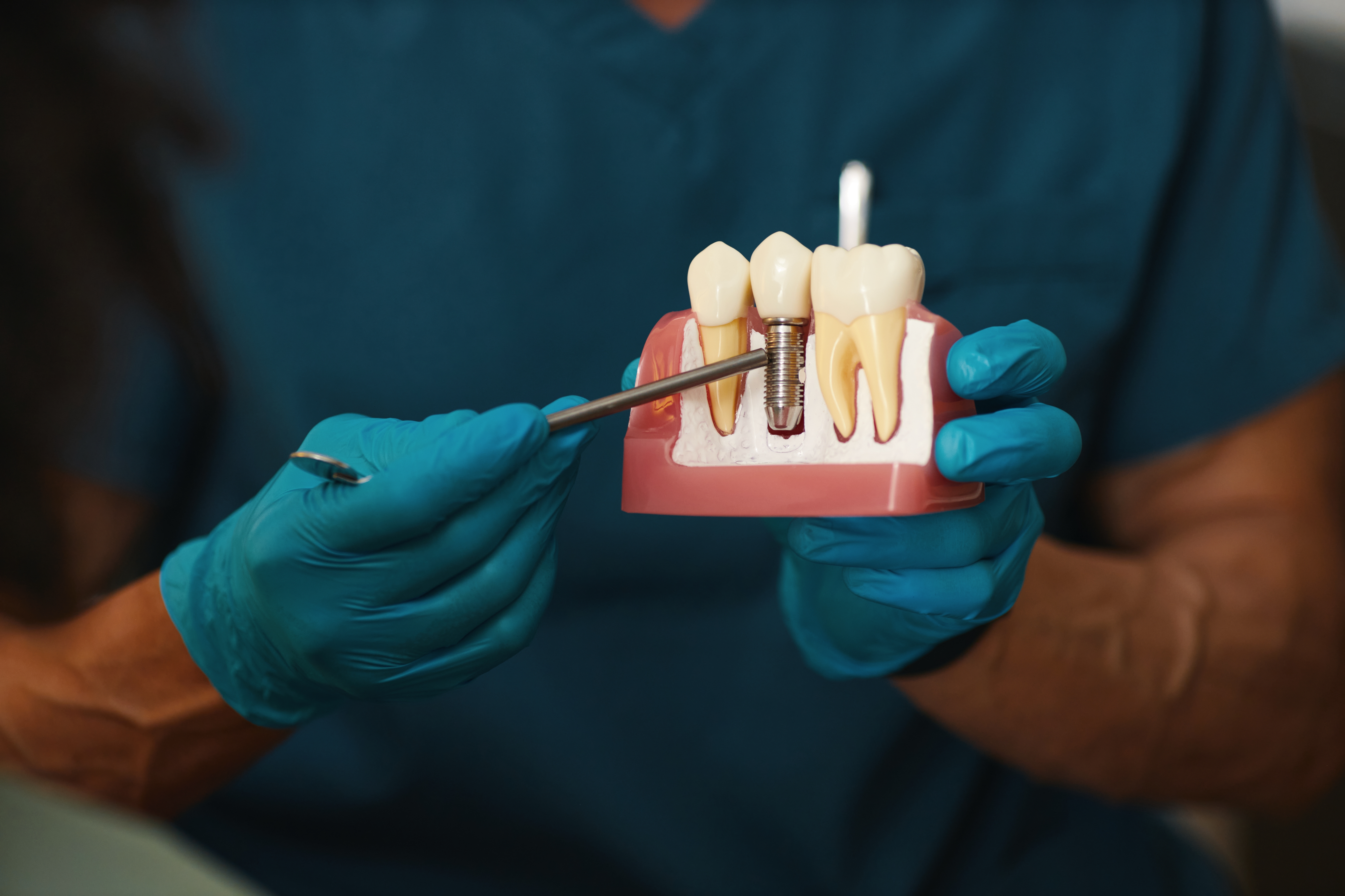 La ce riscuri te expui dacă ai lucrări dentare din metal. Medic: „Sunt materiale pe care trebuie să le evităm”