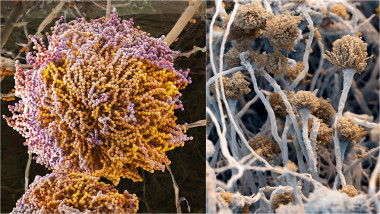 Aspergillus-fumigatus-mucegai-microscop