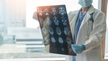 Brain,Disease,Diagnosis,With,Medical,Doctor,Seeing,Magnetic,Resonance,Imaging