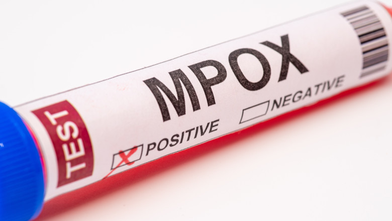 Macedonia de Nord a raportat primele sale două cazuri de infectare cu mpox. Apelul autorităților către cetățeni