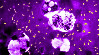 yersinia pestis, bacteria care provoacă ciuma bubonică