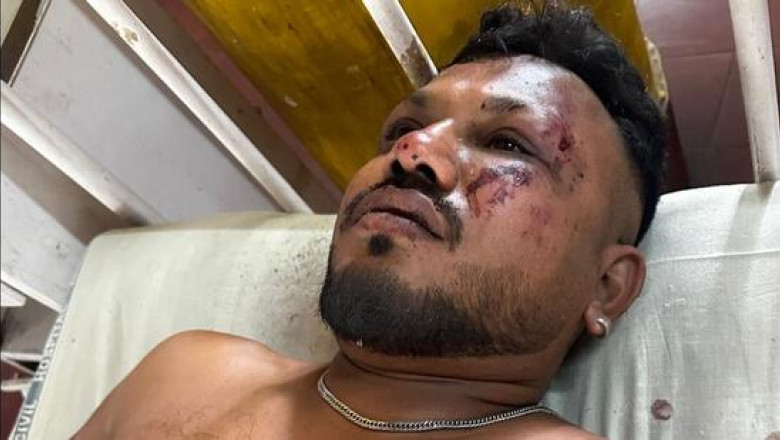 VIDEO  Cine este supraviețuitorul accidentului aviatic din India: „Când m-am ridicat, erau cadavre în jurul meu. Mi-a fost frică”