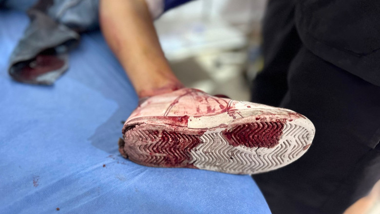 Armata israeliană anchetează posibile crime de război comise în Gaza. Soldații ar fi tras intenționat asupra civililor palestinieni