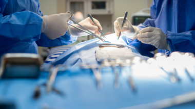 medici in sala de operatie