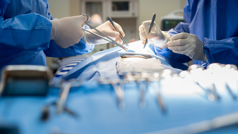 medici in sala de operatie