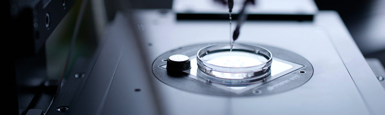 Donarea de ovule