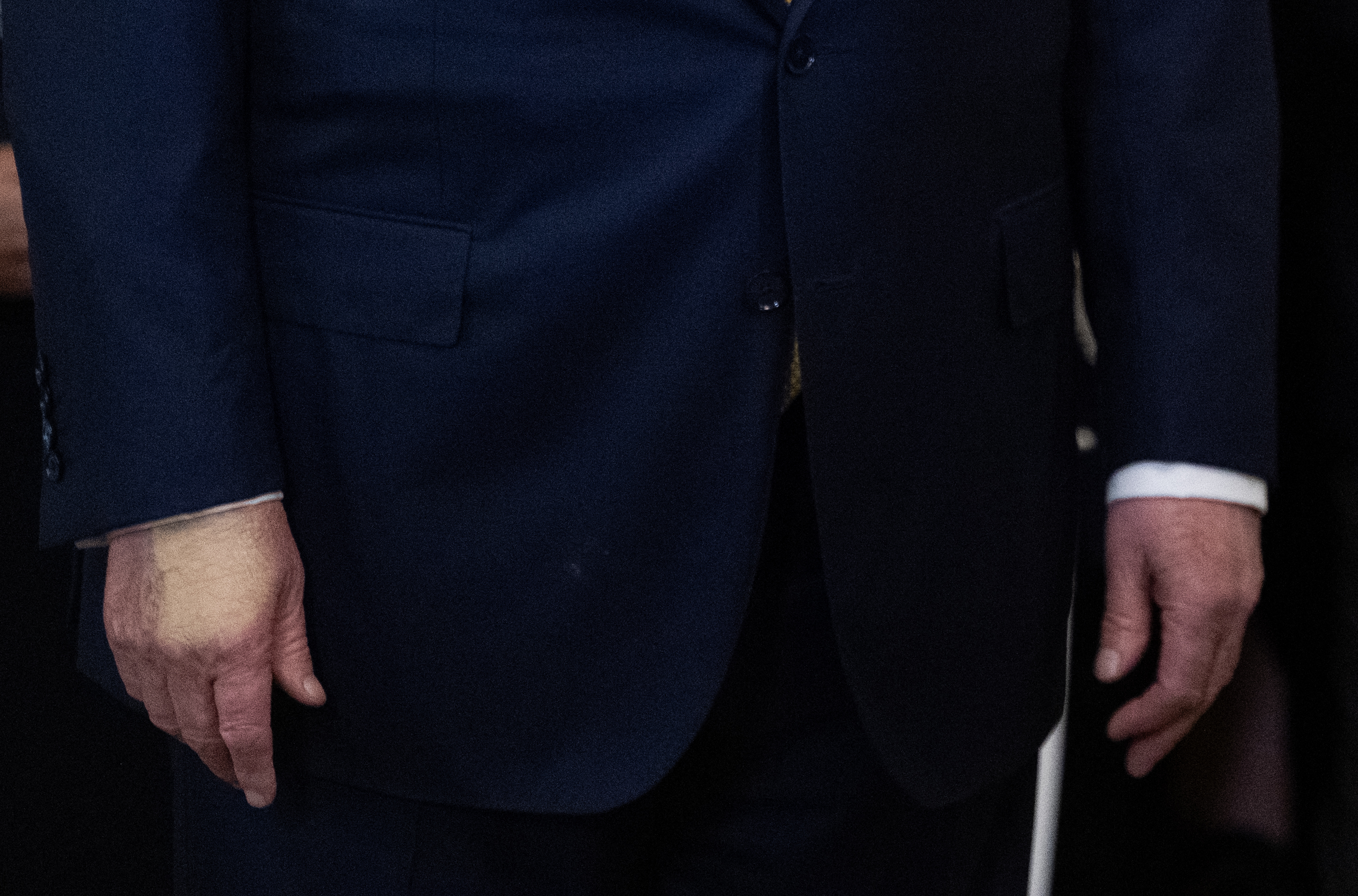 Ce este insuficiența venoasă cronică, boala de care suferă Donald Trump. Medic: „Ridică un semnal de alarmă despre problemele de fond”
