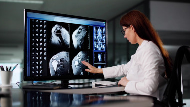 imagini RMN pe calculator într-o clinică