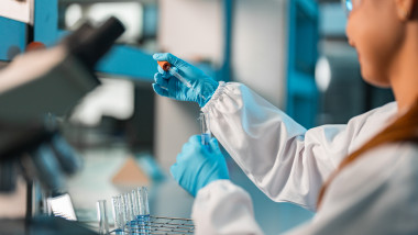 Cum este diagnosticat antraxul. Foto Getty Images