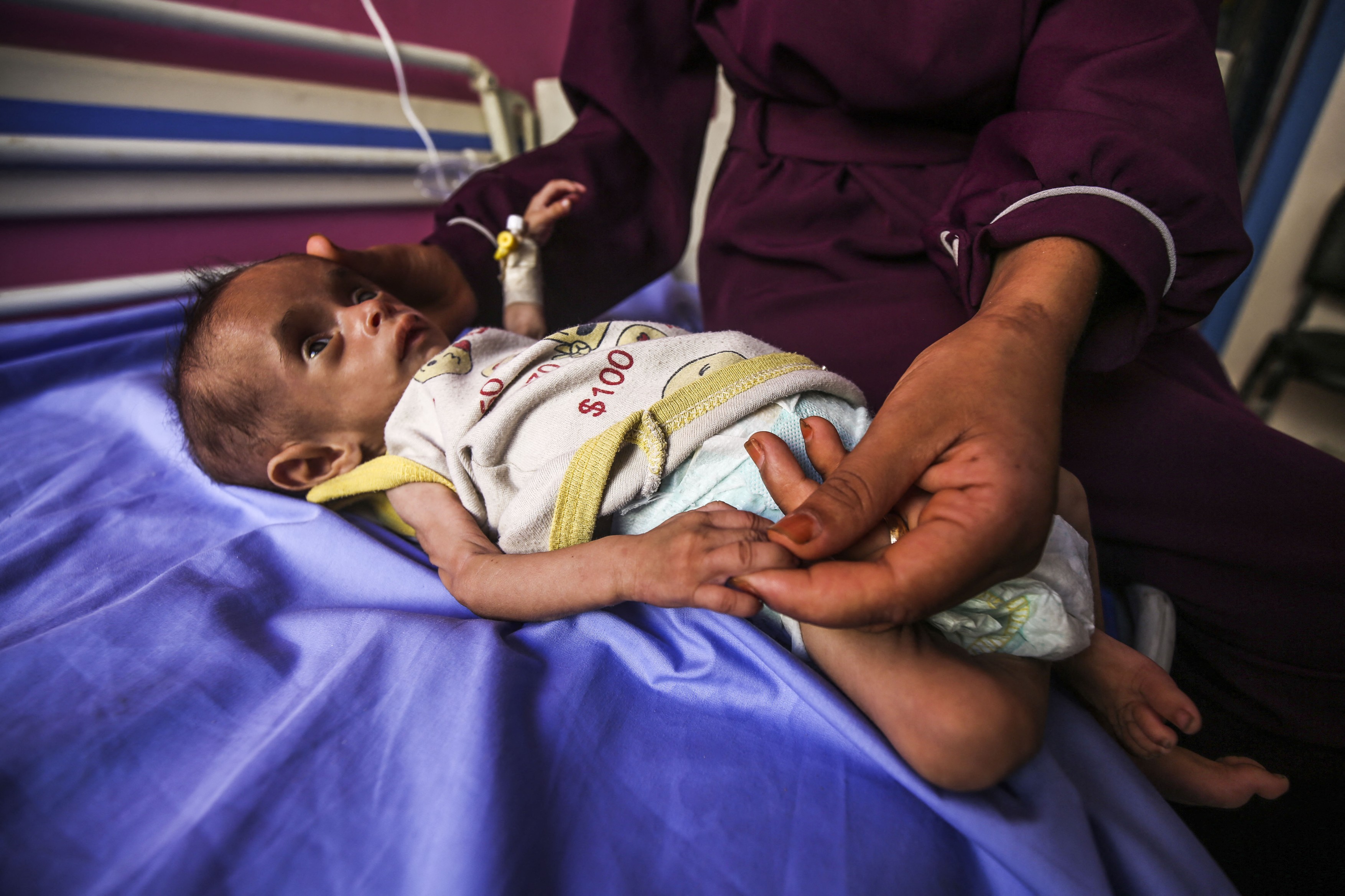 „Înfometare în masă”. Numărul copiilor subnutriți din Gaza, cu vârste sub 5 ani, s-a triplat în ultimele două săptămâni