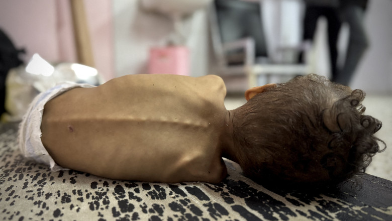„Dacă bebelușul ar putea vorbi, ar țipa, întrebându-ne ce îi punem în stomac”. Nou-născuții din Fâșia Gaza, hrăniți cu ierburi și ceai
