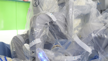 Robot surgery