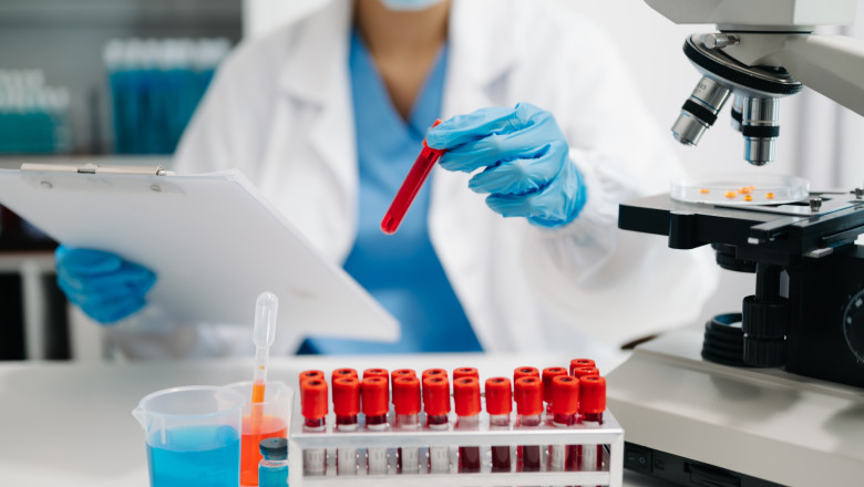 Un test de sânge ar putea depista cu precizie cancerul ovarian în stadii incipiente (studiu)
