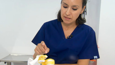 tendinita calcifianta
