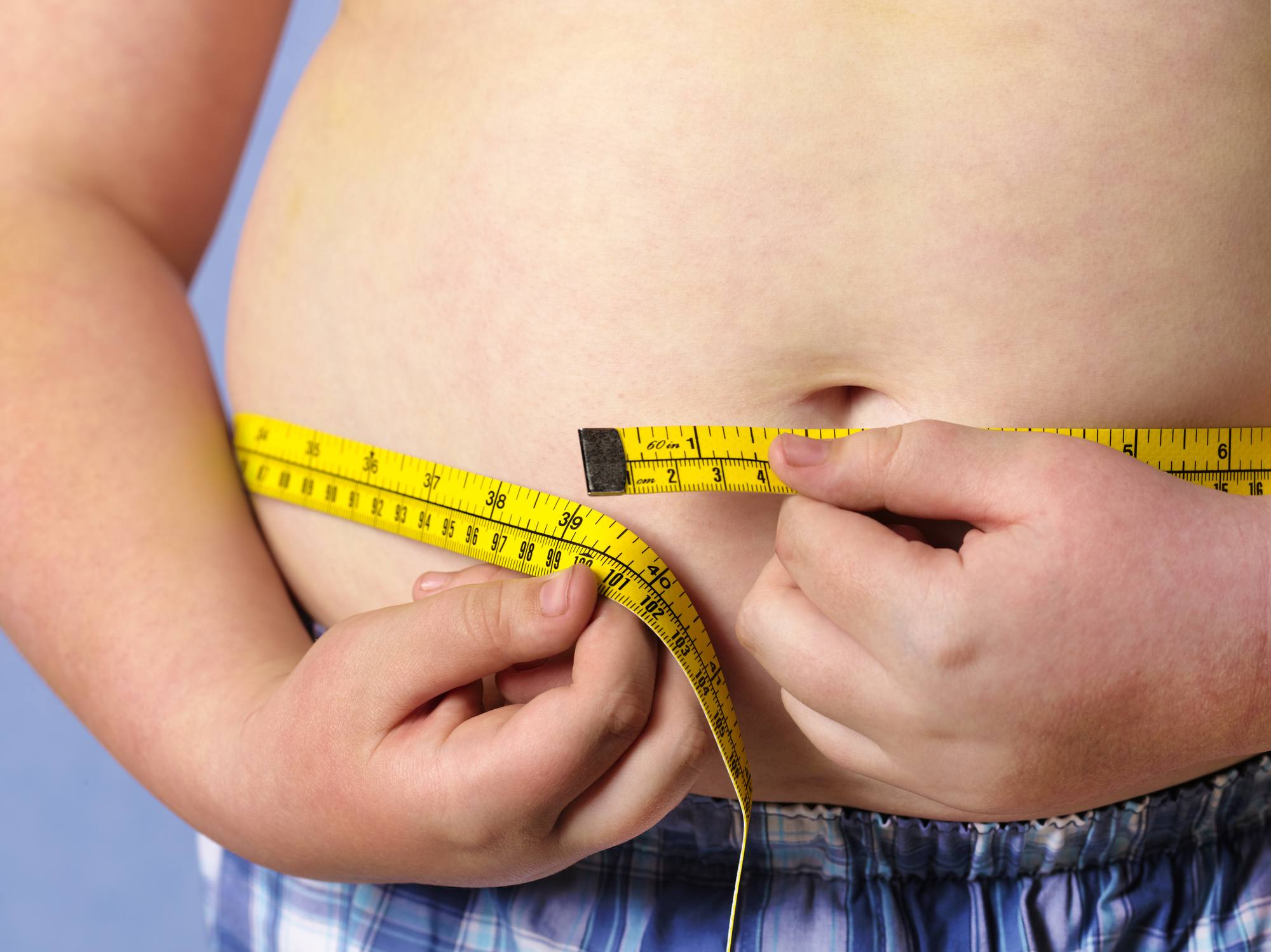 UNICEF: Numarul copiilor care sufera de obezitate s-a triplat in ultimii 25 de ani. Specialist: „Parintii sunt primii vinovati”