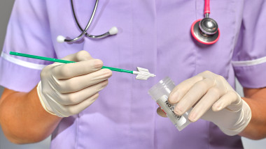 Ce este virusul HPV și cum se transmite. Foto Getty Images