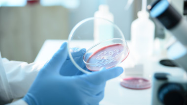 Bacteria Serratia marcescens. Foto Getty Images