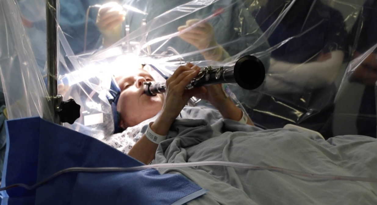 O femeie a cântat la clarinet în timpul unei operații pentru Parkinson. Ce intervenție a suferit și cum o poate ajuta