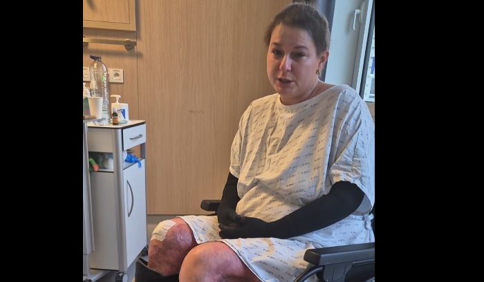 VIDEO Mesajul emoționant al Laviniei, pacienta cu arsuri trimisă în Belgia, înainte de externare: „Azi, în ziua 143, plâng de fericire”