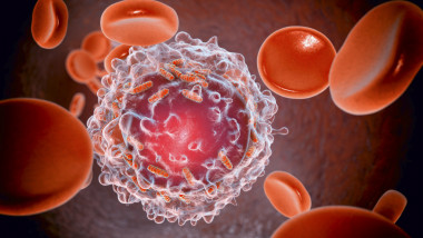 leucemie cancerul sangelui