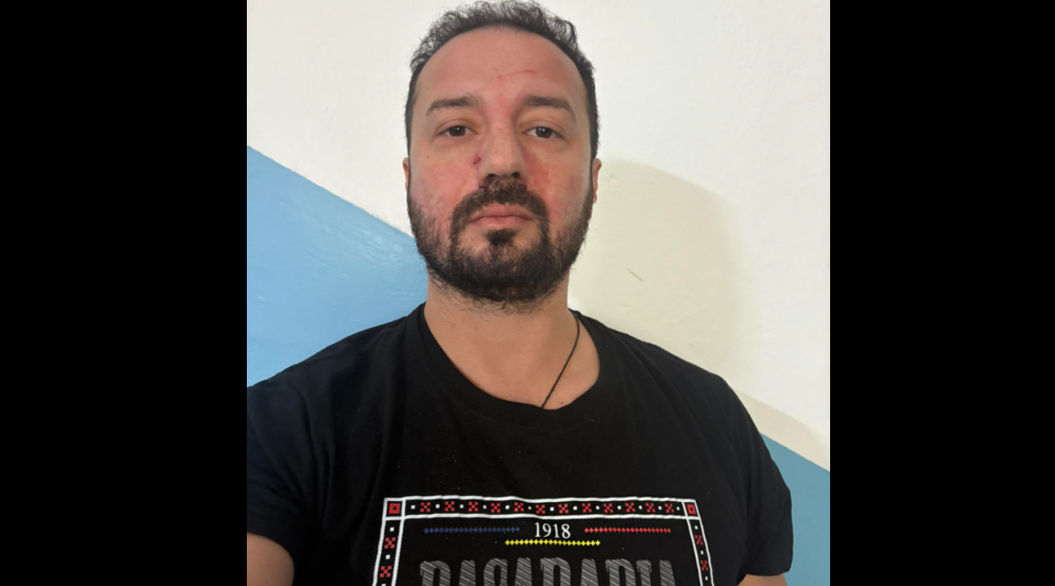 Bărbatul care i-a strigat lui Georgescu „marș la Moscova” afirmă că a fost bătut de susținătorii fostului candidat la prezidențiale